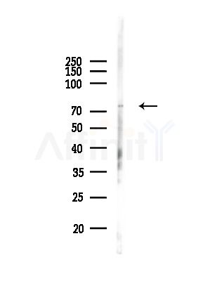 Phospho-GRK2 (Tyr86) Antibody - Western blot analysis of lysates from RAW264.