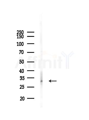Phospho-HNRNPA0 (Ser84) Antibody - Western blot analysis of lysates from COLO205 cells(heat-shock,45min treatment), using Phospho-HNRNPA0 (Ser84) Antibody at 1/1000 dilution.