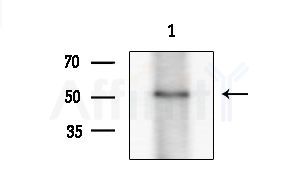 Phospho-IRF5 (Ser437) Antibody - Western blot analysis of extracts from Hela cells(heat-shock treatment), using Phospho-IRF5 (Ser437) Antibody at 1/1000 dilution.