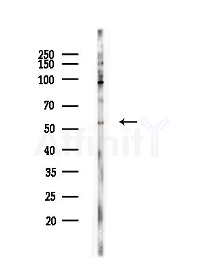 Phospho-IRF5 (Ser437) Antibody - Western blot analysis of lysates from Hela cells(heat-shock,45min treatment), using Phospho-IRF5 (Ser437) Antibody at 1/1000 dilution.