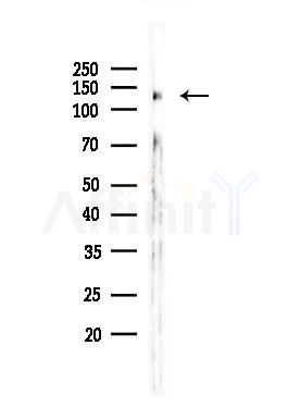 Phospho-Integrin beta 1 (Tyr783) Antibody - Western blot analysis of lysates from HUVEC cells, using Phospho-Integrin beta 1 (Tyr783) Antibody at 1/1000 dilution.