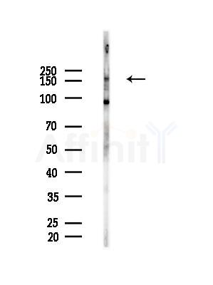 Phospho-c-Met (Tyr1365) Antibody - Western blot analysis of lysates from HepG2 cells(LPS, 4h treatment), using Phospho-c-Met (Tyr1365) Antibody at 1/1000 dilution.