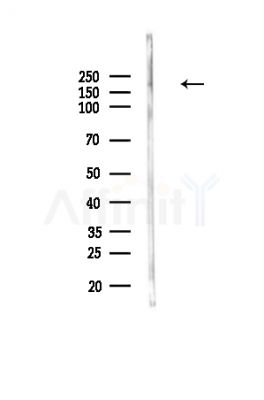Phospho-MLCK (Tyr471) Antibody - Western blot analysis of lysates from Rat liver, using Phospho-MLCK (Tyr471) Antibody at 1/1000 dilution.