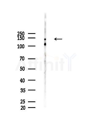 Phospho-Trk B (Tyr817) Antibody - Western blot analysis of lysates from HepG2 cells(LPS, 4h treatment), using Phospho-TrkB (Tyr817) Antibody at 1/1000 dilution.