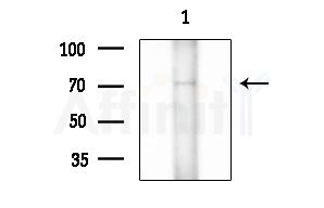 Phospho-PRC1 (Thr470) Antibody - Western blot analysis of extracts from B16F10-LUC cells(starvation treatment), using Phospho-PRC1 (Thr470) Antibody at 1/1000 dilution.