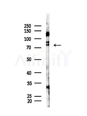 Phospho-PRC1 (Thr470) Antibody - Western blot analysis of lysates from B16F10-LUC cells(starvation,24h treatment), using Phospho-PRC1 (Thr470) Antibody at 1/1000 dilution.