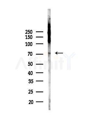 Phospho-PRC1 (Thr481) Antibody - Western blot analysis of lysates from HepG2 cells(UV,30min treatment), using Phospho-PRC1 (Thr481) Antibody at 1/1000 dilution.