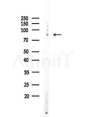 Phospho-PKC alpha (Thr497) Antibody - Western blot analysis of lysates from COLO205 cells, using Phospho-PKC alpha (Thr497) Antibody at 1/1000 dilution.