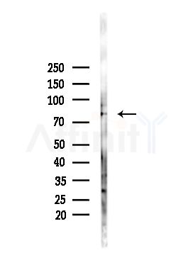 Phospho-PKC alpha (Ser657) Antibody - Western blot analysis of lysates from PC12 cells(heat-shock,45min treatment), using Phospho-PKC alpha (Ser657) Antibody at 1/1000 dilution.
