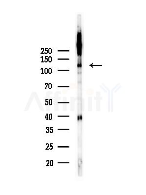 Phospho-RBL2 (Thr642) Antibody - Western blot analysis of lysates from HepG2 cells(UV,30min treatment), using Phospho-RBL2 (Thr642) Antibody at 1/1000 dilution.