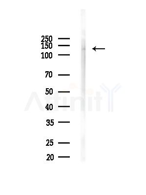 Phospho-RBL2 (Ser639) Antibody - Western blot analysis of lysates from Mouse brain, using Phospho-RBL2 (Ser639) Antibody at 1/1000 dilution.