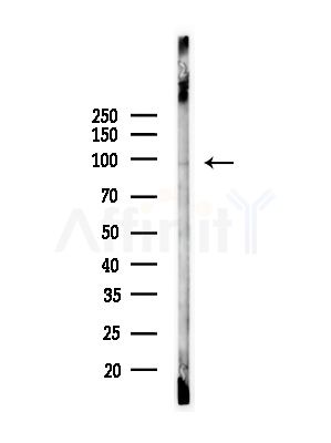Phospho-AR (Ser792) Antibody - Western blot analysis of lysates from HepG2 cells(UV,30min treatment), using Phospho-AR (Ser792) Antibody at 1/1000 dilution.
