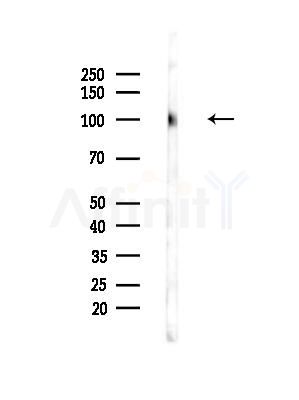 AXL Antibody - Western blot analysis of lysates from COLO205 cells(heat-shock,45min treatment), using AXL Antibody at 1/1000 dilution.