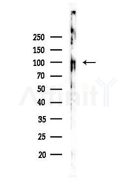 Phospho-EPHA1 (Tyr781) Antibody - Western blot analysis of lysates from Rat brain, using Phospho-EPHA1 (Tyr781) Antibody at 1/1000 dilution.
