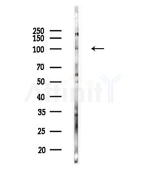 Phospho-EPHA5 (Tyr650) Antibody - Western blot analysis of lysates from COLO205 cells(UV,30min treatment), using Phospho-EPHA5 (Tyr650) Antibody at 1/1000 dilution.