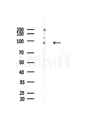 Phospho-FGFR2 (Ser782) Antibody - Western blot analysis of lysates from HepG2 cells(LPS, 4h treatment), using Phospho-FGFR2 (Ser782) Antibody at 1/1000 dilution.