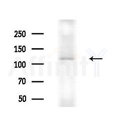 Phospho-MYPT1 (Ser507) Antibody - Western blot analysis of extracts from Rat lung, using Phospho-MYPT1 (Ser507) Antibody at 1/1000 dilution.