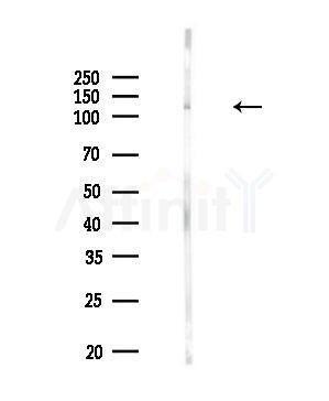 Phospho-MYPT1 (Ser507) Antibody - Western blot analysis of lysates from Rat lung, using Phospho-MYPT1 (Ser507) Antibody at 1/1000 dilution.