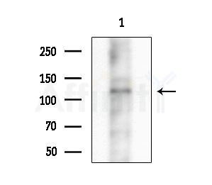 Phospho-MYPT1/2 (Ser668/Ser618) Antibody - Western blot analysis of extracts from B16F10-LUC cells(starvation treatment), using Phospho-MYPT1/2 (Ser668/Ser618) Antibody at 1/1000 dilution.