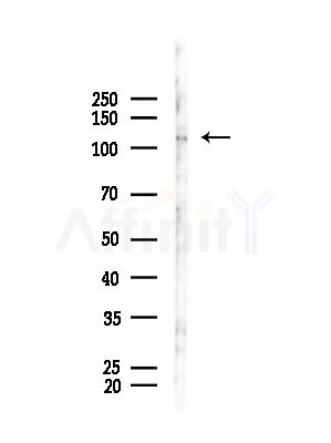 Phospho-MYPT1/2 (Ser668/Ser618) Antibody - Western blot analysis of lysates from B16F10-LUC cells(starvation,24h treatment), using Phospho-MYPT1/2 (Ser668/Ser618) Antibody at 1/1000 dilution.