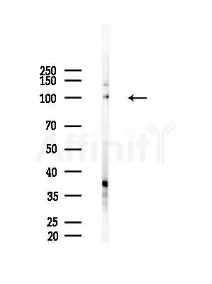 Phospho-ROR1 (Tyr786) Antibody - Western blot analysis of lysates from HepG2 cells(LPS, 4h treatment), using Phospho-ROR1 (Tyr786) Antibody at 1/1000 dilution.
