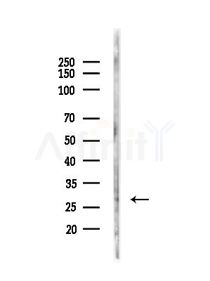 Phospho-14-3-3 sigma (Ser186) Antibody - Western blot analysis of lysates from Mouse testis, using Phospho-14-3-3 sigma (Ser186) Antibody at 1/1000 dilution.