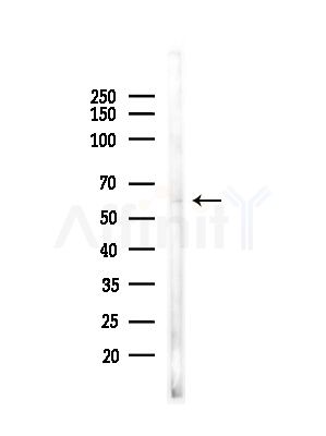 Phospho-BCL-3 (Ser402) Antibody - Western blot analysis of lysates from Mouse testis, using Phospho-BCL-3 (Ser402) Antibody at 1/1000 dilution.