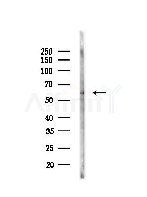 Phospho-MAP3K8/COT (Ser400) Antibody - Western blot analysis of lysates from HepG2 cells(UV,30min treatment), using Phospho-MAP3K8/COT (Ser400) Antibody at 1/1000 dilution.