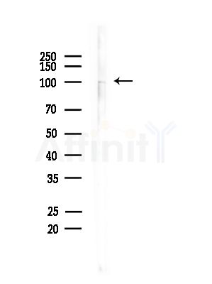 Phospho-HSP105 (Ser809) Antibody - Western blot analysis of lysates from Mouse brain, using Phospho-HSP105 (Ser809) Antibody at 1/1000 dilution.