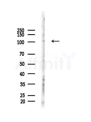 Phospho-INCENP (Thr59) Antibody - Western blot analysis of lysates from HepG2 cells(LPS, 4h treatment), using Phospho-INCENP (Thr59) Antibody at 1/1000 dilution.