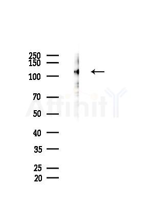 Phospho-MCM2 (Ser27) Antibody - Western blot analysis of lysates from B16F10-HUC(heat-shock treatment), using Phospho-MCM2 (Ser27) Antibody at 1/1000 dilution.