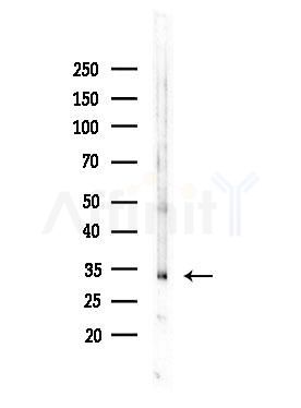 Phospho-MyD88 (Tyr257) Antibody - Western blot analysis of lysates from COLO205 cells, using Phospho-MyD88 (Tyr257) Antibody at 1/1000 dilution.