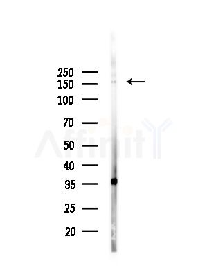 Phospho-SRC3 (Ser857) Antibody - Western blot analysis of lysates from HepG2 cells(UV,30min treatment), using Phospho-SRC3 (Ser857) Antibody at 1/1000 dilution.