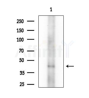Phospho-NDRG1 (Ser330) Antibody - Western blot analysis of lysates from Mouse testis, using Phospho-NDRG1 (Ser330) Antibody at 1/1000 dilution.