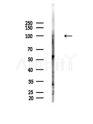 Phospho-NHE-3 (Ser555) Antibody - Western blot analysis of lysates from HepG2 cells(LPS, 4h treatment), using Phospho-NHE-3 (Ser555) Antibody at 1/1000 dilution.