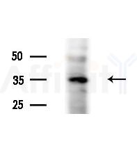 Phospho-Nucleophosmin (Ser4) Antibody - Western blot analysis of lysates from EC304 cells, using Phospho-Nucleophosmin (Ser4) Antibody at 1/1000 dilution.