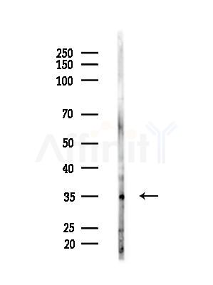 Phospho-Nucleophosmin (Ser4) Antibody - Western blot analysis of lysates from EC304 cells, using Phospho-Nucleophosmin (Ser4) Antibody at 1/1000 dilution.