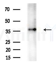 Phospho-Nucleophosmin (Ser70) Antibody - Western blot analysis of lysates from Rat brain, using Phospho-Nucleophosmin (Ser70) Antibody at 1/1000 dilution.