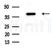 Phospho-Nucleophosmin (Ser70) Antibody - Western blot analysis of lysates from HepG2 cells(starvation treatment), using Phospho-Nucleophosmin (Ser70) Antibody at 1/1000 dilution.