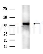 Phospho-Nucleophosmin (Ser70) Antibody - Western blot analysis of lysates from Mouse liver, using Phospho-Nucleophosmin (Ser70) Antibody at 1/1000 dilution.