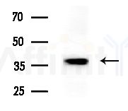 Phospho-Nucleophosmin (Ser70) Antibody - Western blot analysis of lysates from B16F10-HUC(heat-shock treatment), using Phospho-Nucleophosmin (Ser70) Antibody at 1/1000 dilution.