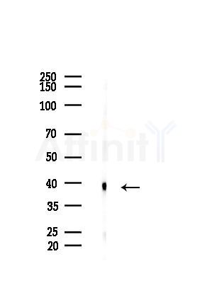 Phospho-Nucleophosmin (Ser70) Antibody - Western blot analysis of lysates from B16F10-HUC(heat-shock treatment), using Phospho-Nucleophosmin (Ser70) Antibody at 1/1000 dilution.