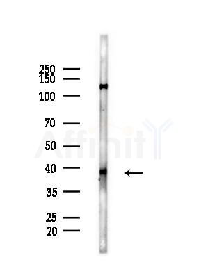 Phospho-Nucleophosmin (Ser70) Antibody - Western blot analysis of lysates from Mouse liver, using Phospho-Nucleophosmin (Ser70) Antibody at 1/1000 dilution.