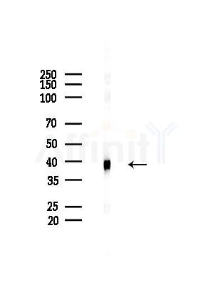 Phospho-Nucleophosmin (Ser70) Antibody - Western blot analysis of lysates from HepG2 cells(starvation treatment), using Phospho-Nucleophosmin (Ser70) Antibody at 1/1000 dilution.