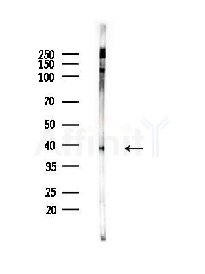 Phospho-Nucleophosmin (Ser70) Antibody - Western blot analysis of lysates from Rat brain, using Phospho-Nucleophosmin (Ser70) Antibody at 1/1000 dilution.