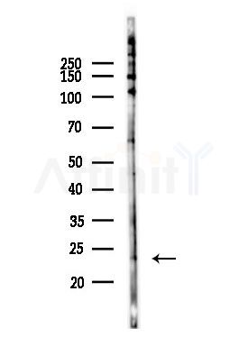 Phospho-p21 Cip1 (Thr57) Antibody - Western blot analysis of lysates from EC304 cells(heat-shock,45min treatment), using Phospho-p21 Cip1 (Thr57) Antibody at 1/1000 dilution.