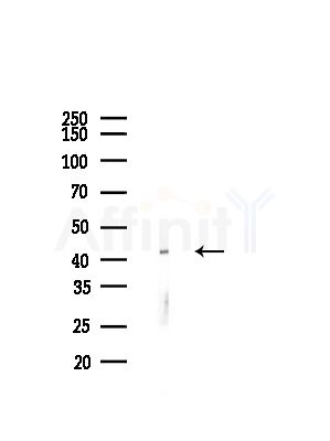 Phospho-PDHA1/2 (Ser293/Ser291) Antibody - Western blot analysis of lysates from COLO205 cells(heat-shock,45min treatment), using Phospho-PDHA1/2 (Ser293/Ser291) Antibody at 1/1000 dilution.