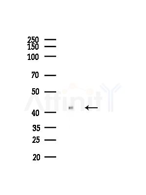 Phospho-PDHA1/2 (Ser293/Ser291) Antibody - Western blot analysis of lysates from Hela cells(LPS, 4h treatment), using Phospho-PDHA1/2 (Ser293/Ser291) Antibody at 1/1000 dilution.