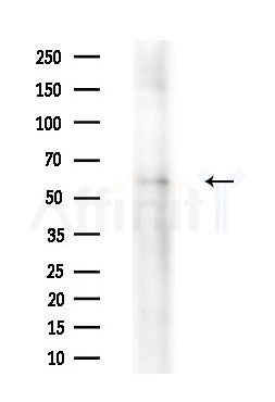 Phospho-PNKP (Ser114) Antibody - Western blot analysis of lysates from A549 cells(heat-shock treatment), using Phospho-PNKP (Ser114) Antibody at 1/1000 dilution.