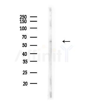 Phospho-PNKP (Ser114) Antibody - Western blot analysis of lysates from A549 cells(heat-shock,45min treatment), using Phospho-PNKP (Ser114) Antibody at 1/1000 dilution.